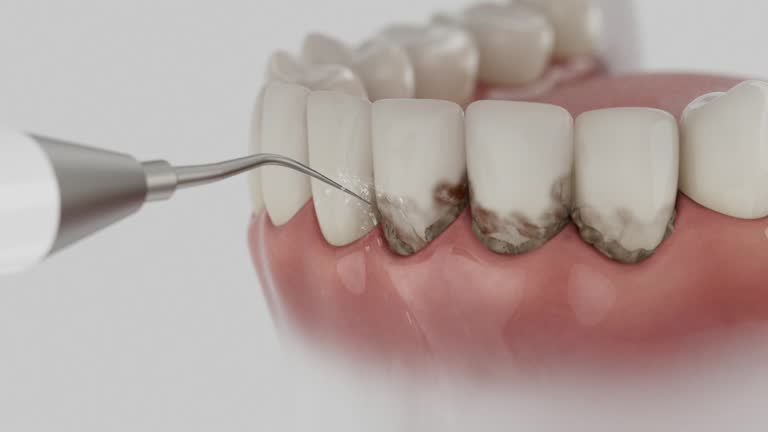 Trusted Root Canal Treatment service in Fort Sumner, NM - Dentist Open Now